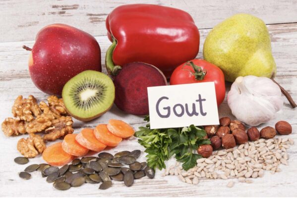 Bệnh nhân gout nên ăn uống gì và kiêng gì?