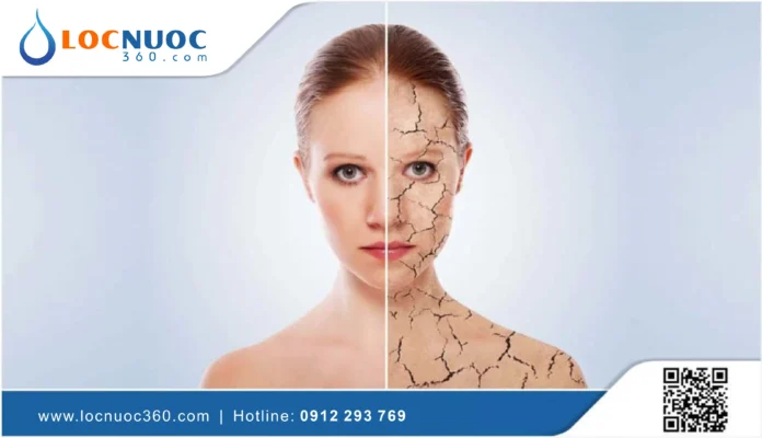 Những điều cần biết khi cơ thể bạn bị mất nước