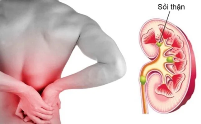Cơ thể nguy hại như thế nào khi ngừng uống nước?