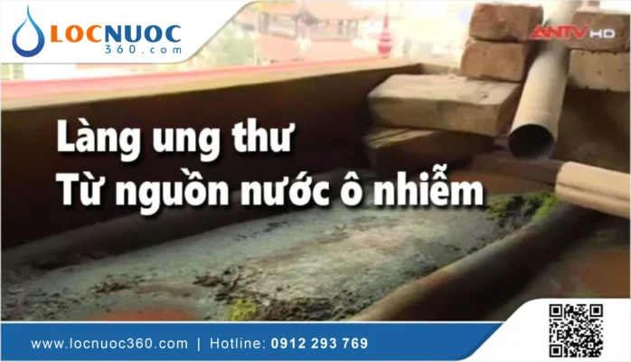 “Làng ung thư” khát nước sạch