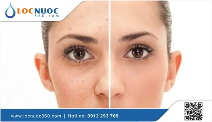 Những điều bạn cần biết về tình trạng mất nước của cơ thể
